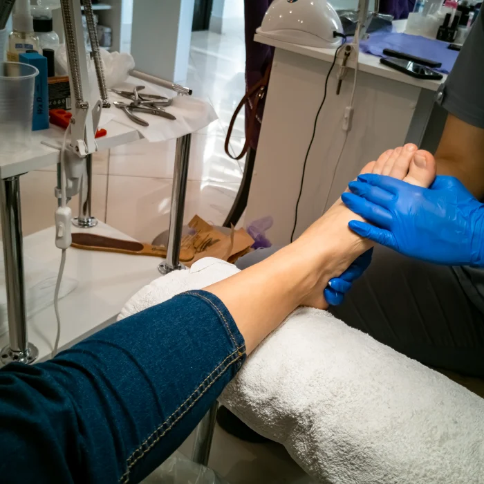 Ingrown Toenail Removal image